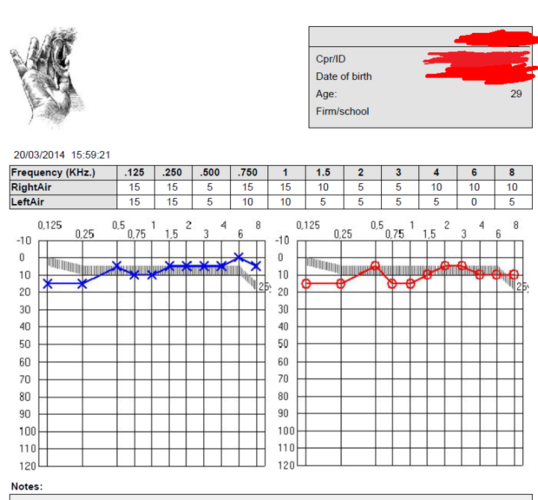 这样的听力曲线如何正常吗