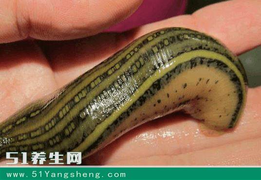 这种虫子吸血为生,却能够治疗心血管疾病,你见过吗?