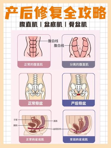 产后修复全攻略盆底肌腹直肌骨盆肌