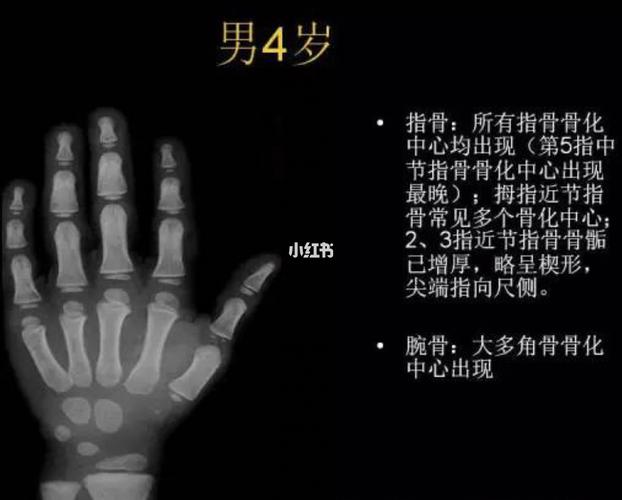 一岁到五岁骨龄鉴别图_医学生_医疗健康_医疗健康其他