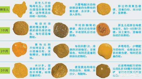 新生儿的大便里有奶瓣,该怎么办?