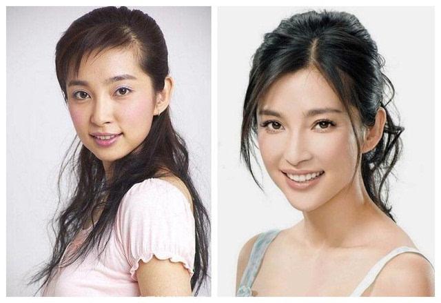 3,牙齿矫正:以前的李冰冰有少许龅牙,嘴巴有点点凸.