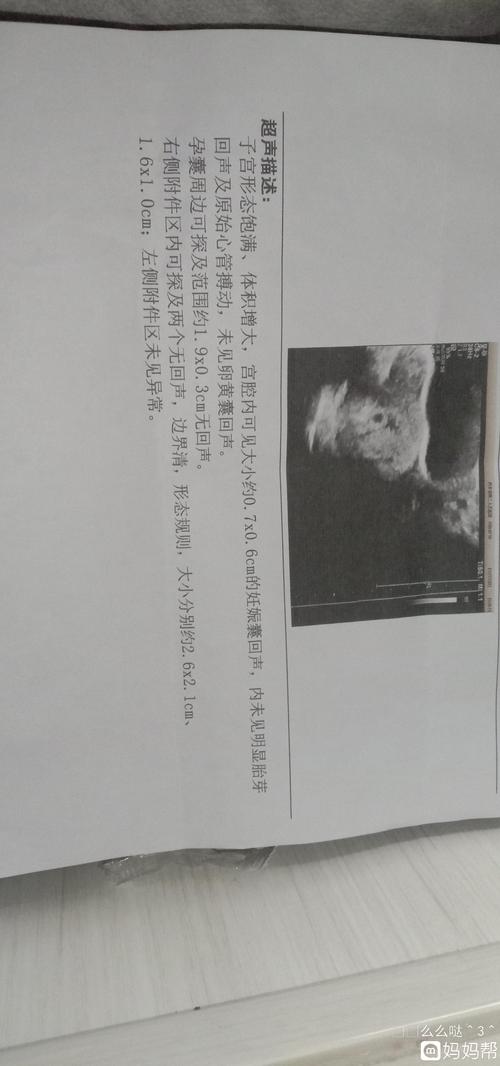 怀孕35天做的彩超,谁能帮忙看下这个是怎