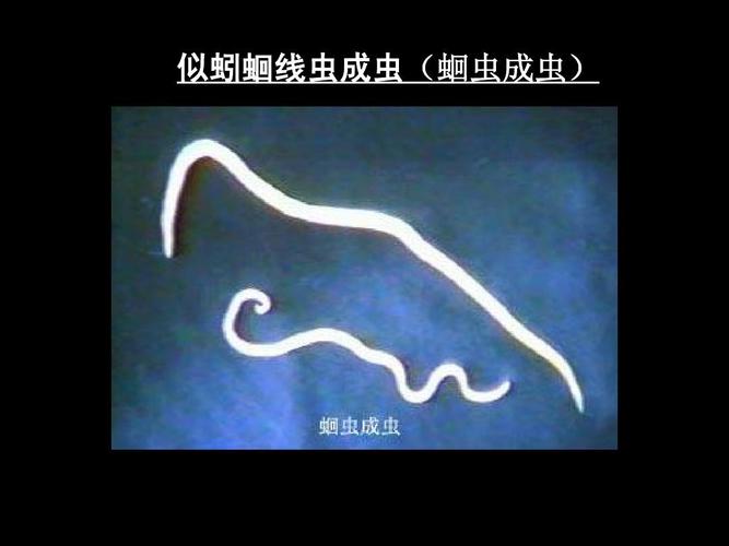 病原生物学 人体寄生虫标本复习答案ppt