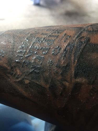 着急 纹身后15天 皮肤有凸起 看起亮亮的 怎么办