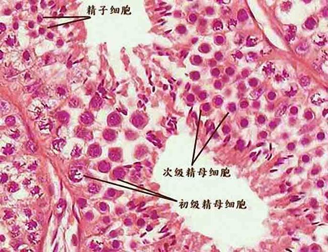 从而取出一小块活体睾丸组织,然后再进行病理切片组织咽滓 咨询 男性