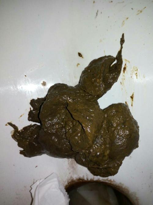胃病啊屎颜色是这样是什么病?