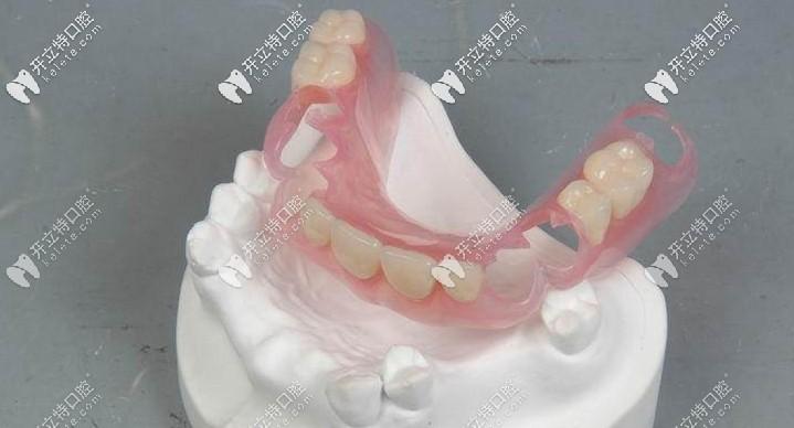年轻人前门牙缺失戴活动假牙,用隐形义齿和钢托哪个效果好