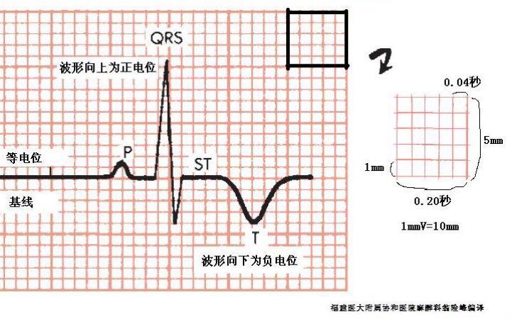 向上的波称为正电位,向下的波称为负电位,基线则是等电位,有的波部分