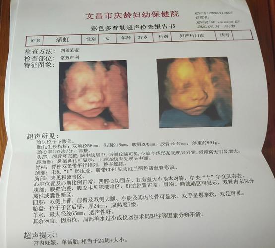 这是我的四维彩超检查照片,哈哈,是不是很丑呢.因为我还在慢慢成长中.