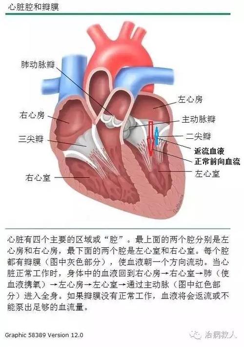 于泓医生:二尖瓣返流小知识