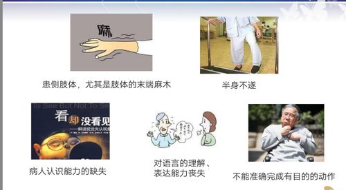 约占脑卒中的70%,,包括脑血栓形成和脑栓塞出血性脑卒中俗称脑溢血