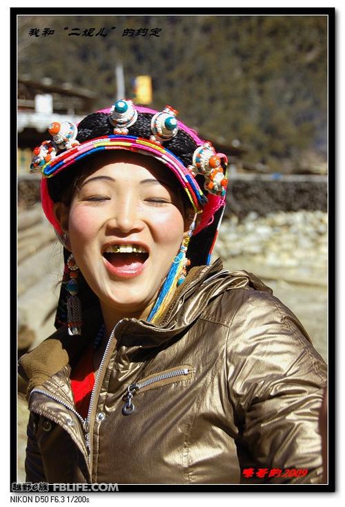 她们认为镶了金牙更好看