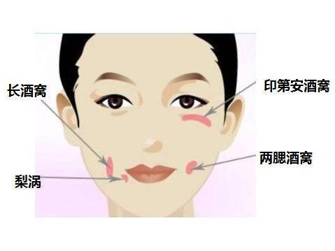 酒窝属于面部残废?