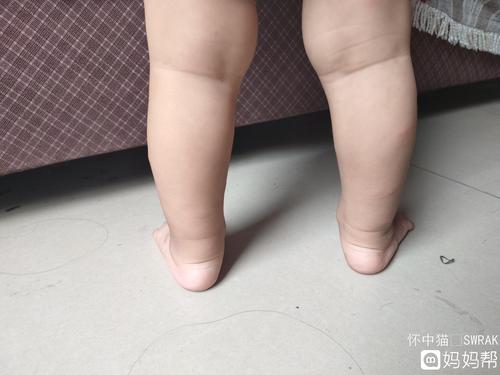 宝宝十四个月的了,脚后跟这样正常么,是不