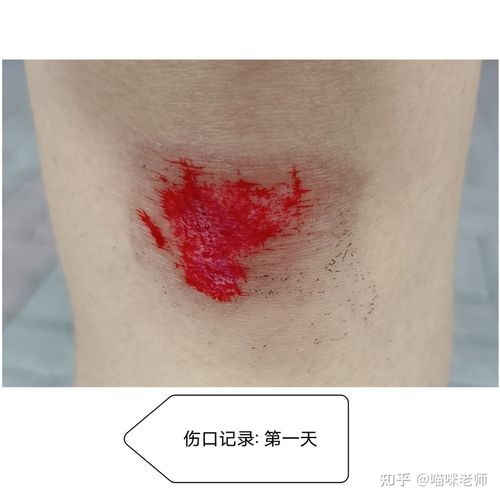 记录膝盖摔伤的整个伤口愈合过程,每天拍一张照片.