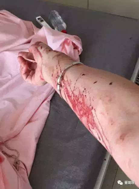 投诉快递员女子遭毒打!他们掌握所有信息,以后怎么办