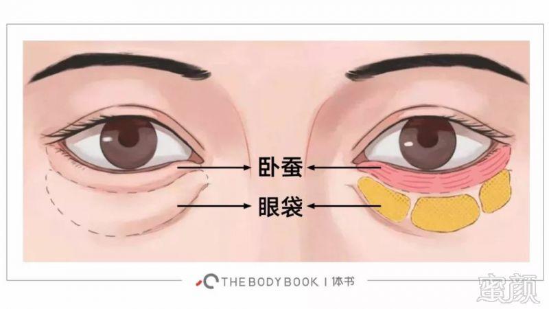 关于眼袋,泪沟,卧蚕的迷思