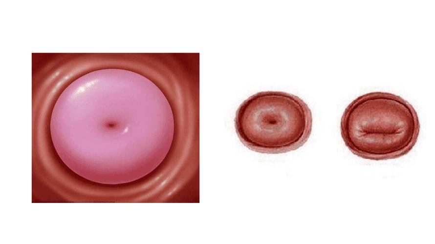宫颈基础知识