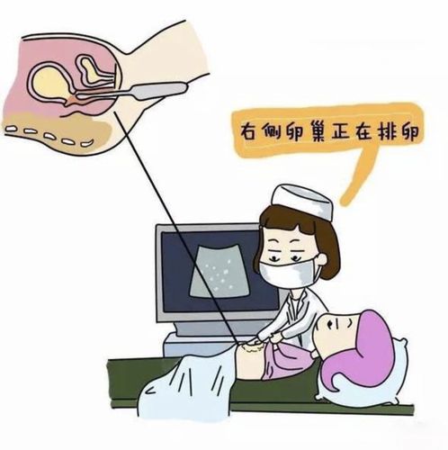 (4)更适合于腹壁肥厚,卵巢位置过深,或腹部彩超检查有困难的人群.