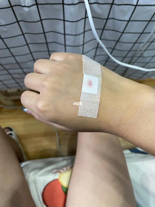 输液扎针体验_输液_医疗健康_医疗健康其他