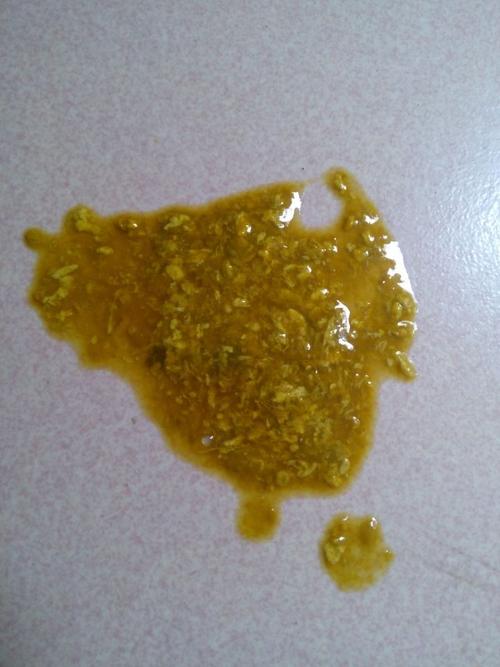 宝宝刚好一个月,这几天拉这样的便便正常不,我是混合喂养的,奶粉和