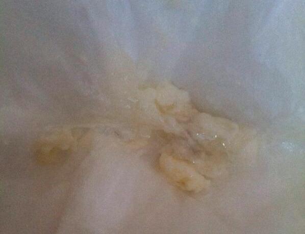 宫颈糜烂排出脏东西了,舒服了只看楼主