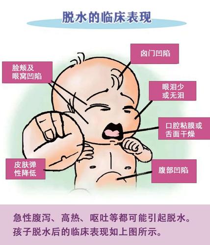 "秋冬腹泻"来势凶猛,这些宝宝护理要点宝妈必看!