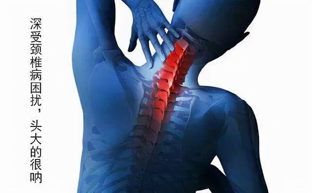 最常见的神经根型颈椎病居然有这么多危害可能你已经得了