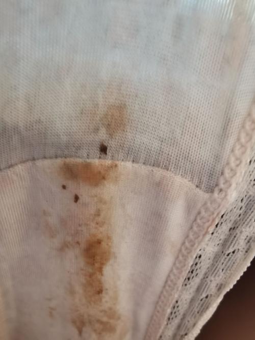 [试管婴儿]这几天内裤上总有些褐色分泌物