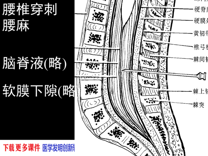 椎管解剖腰麻骶管麻醉基础