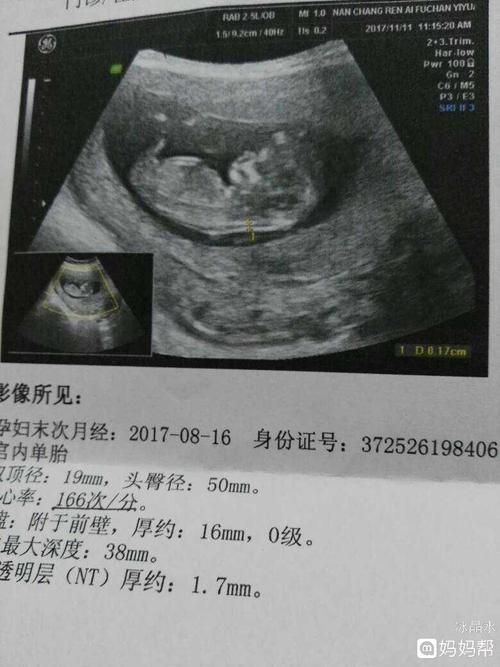 nt可以看出男孩还是女孩吗