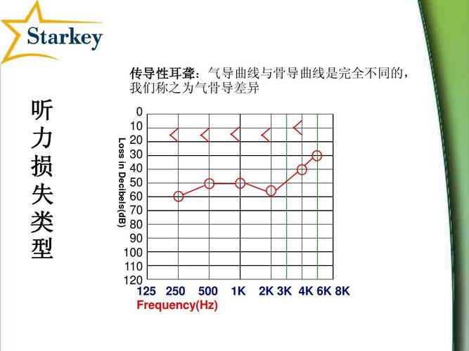气导曲线与骨导曲线是完全不同的,我们称之为气骨导差异 听力损失类型