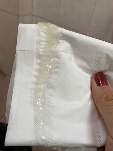白带像白色透明鼻涕,这是在排卵期吗?