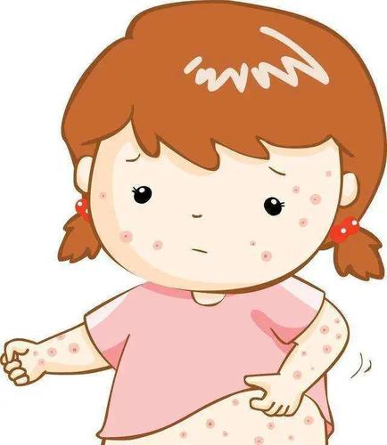 这种病不起眼,却能让你痒到怀疑人生,春季高发!_皮肤