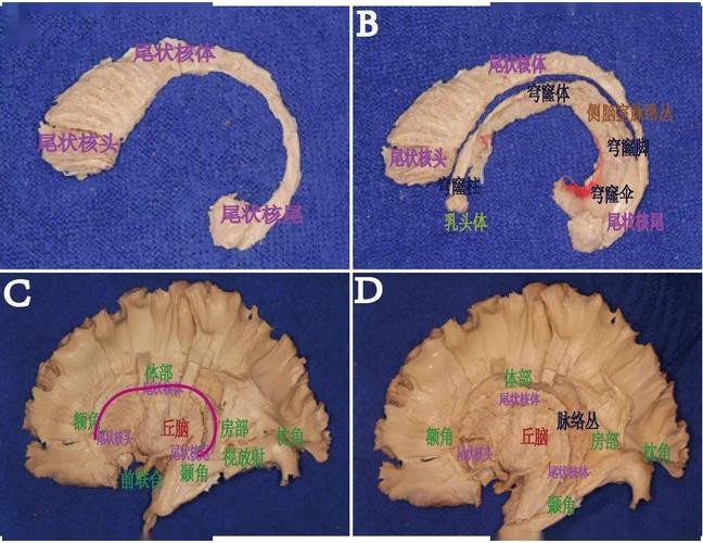 fig  :两个"c形"结构:尾状核,穹窿及相关解剖结构