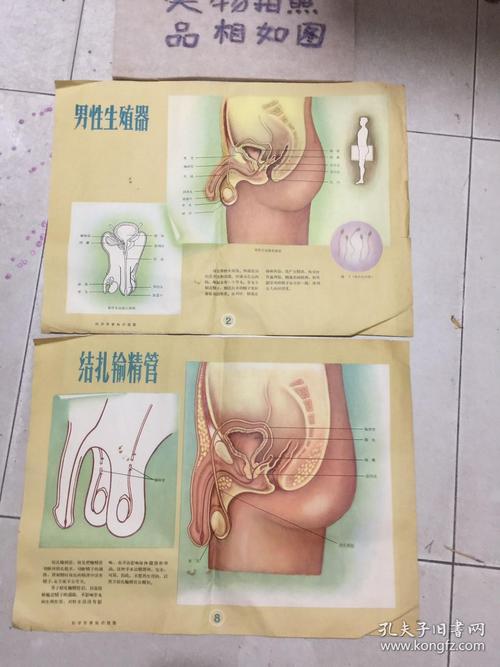 50年代 男性生殖器,结扎输精管 挂图2张
