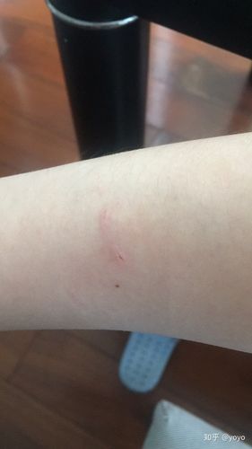 家里长期养猫或狗的,是不是大多都被猫狗咬过?
