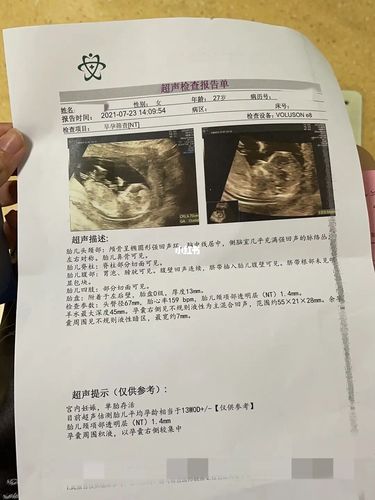 nt秒过,这会是男宝宝还是女宝宝_nt检查_女宝宝_nt检查_母婴_孕产经验