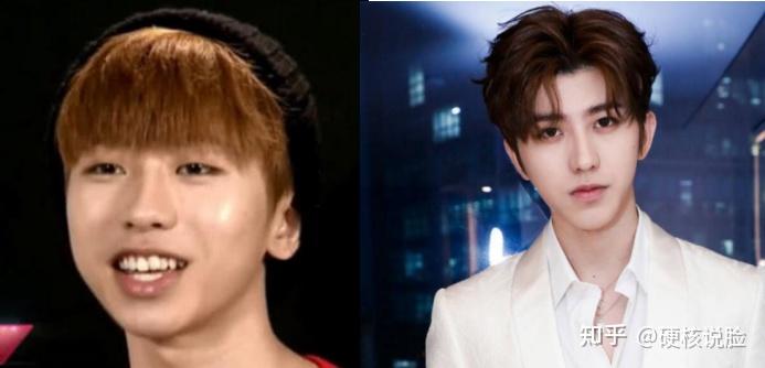 娱乐圈扒皮系列——第十一期,蔡徐坤整容史