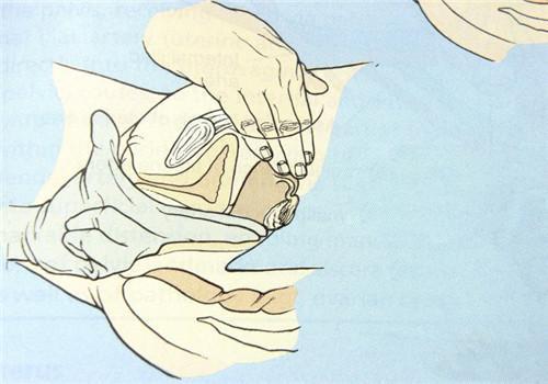 什么是"开10指"从开始宫缩到开十指准备生产,是一个漫长而痛苦的过程