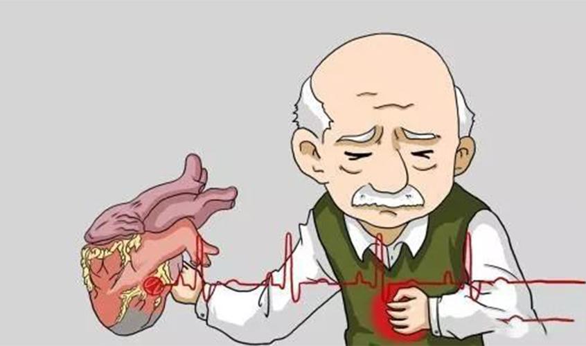 高血压性心脏病的症状与治疗