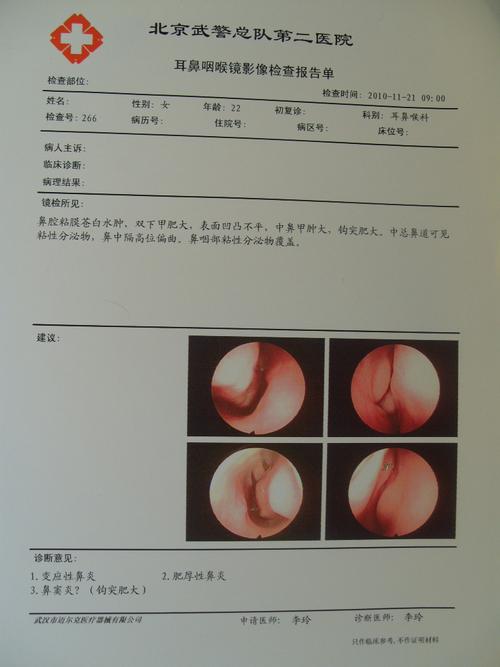 耳鼻咽喉镜影像检查报告单,医生请进,谢谢