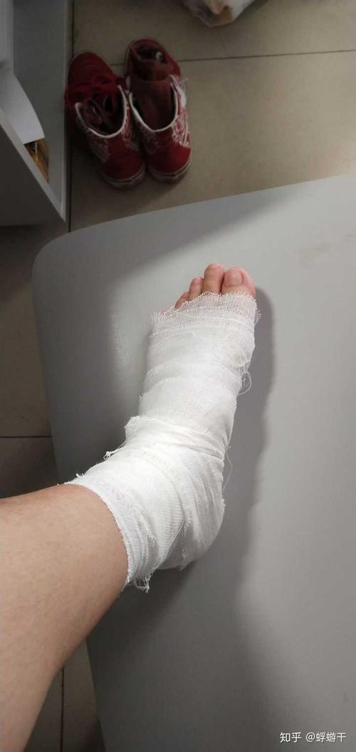 会了ollie,但我脚崴了,啊哈哈哈.