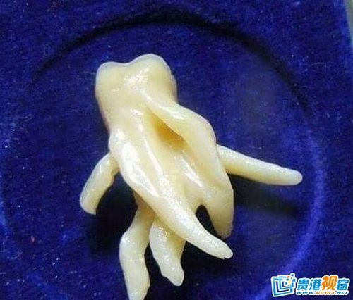 牙医晒出来的一颗妖娆智齿