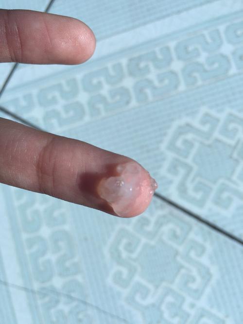 白带这样的透明还带有白色像鼻涕一样粘稠这是正常的吗