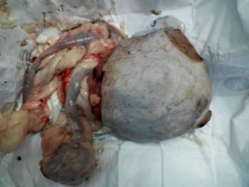 18                      我们知道乳腺囊肿在快节奏的今天已成为女性