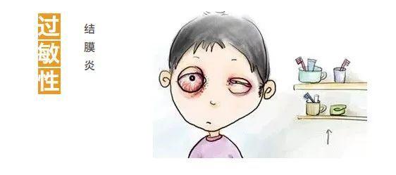 3种类型的结膜炎治疗方法上有什么不同