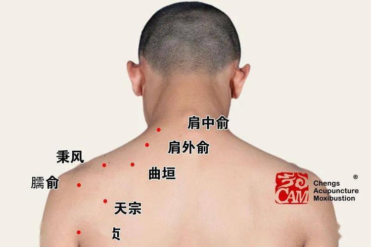 天宗,天髎上,膏肓,肩井,大椎,臂丛神经点,中府,玉枕,天柱,完骨等穴
