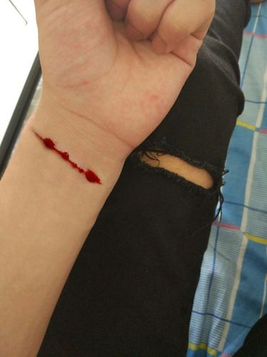 求ps大神帮我把p下图中伤疤p到另一张图上,后面再追加